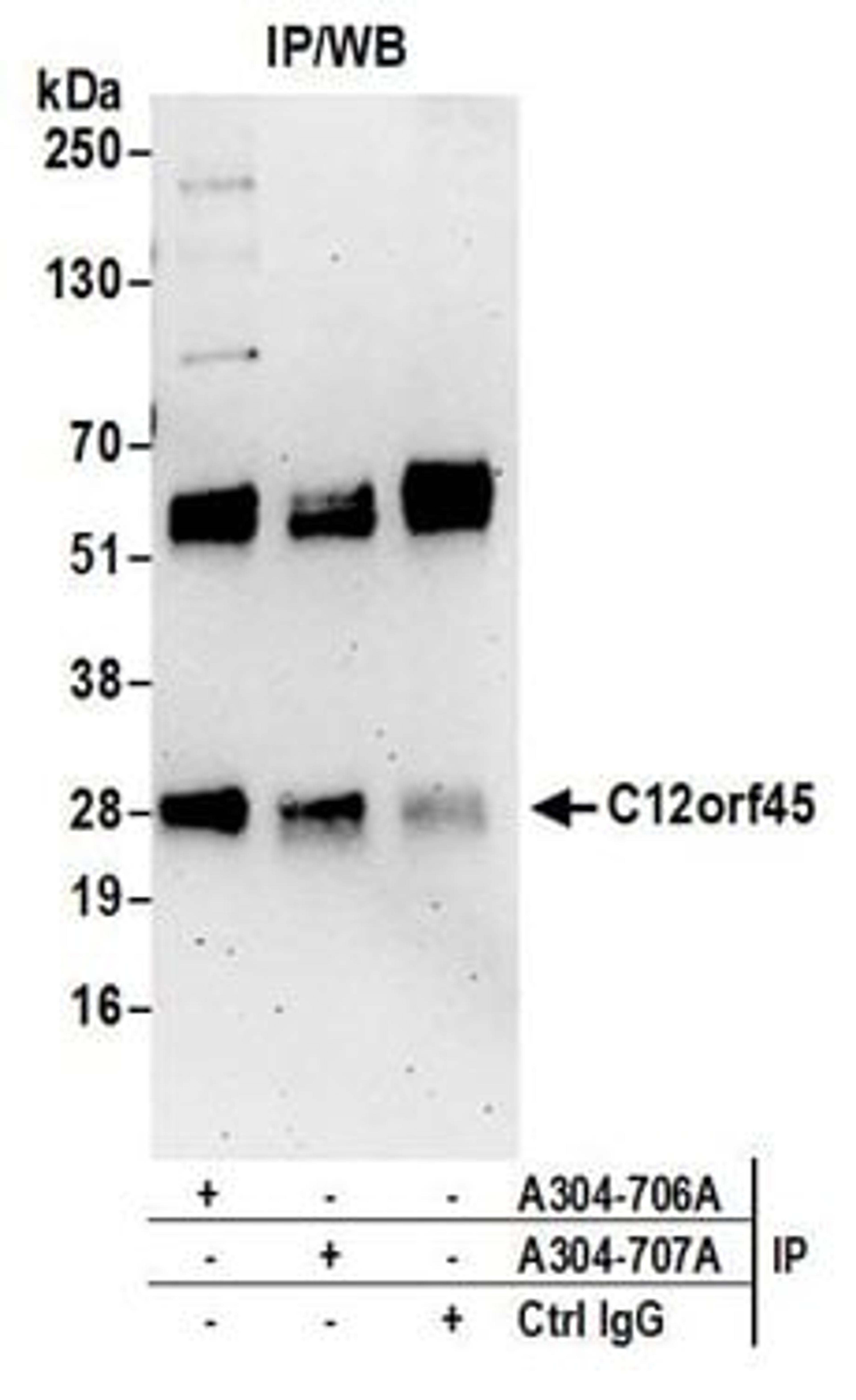 Detection of human C12orf45 by western blot of immunoprecipitates.