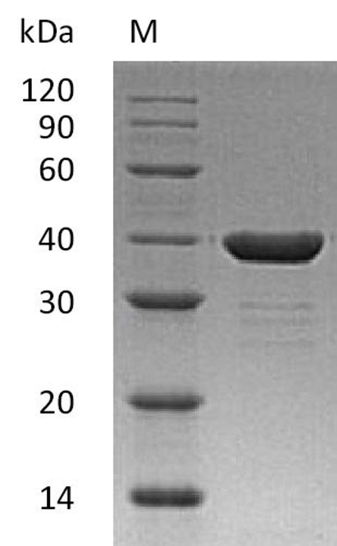 (Tris-Glycine gel) Discontinuous SDS-PAGE (reduced) with 5% enrichment gel and 15% separation gel.