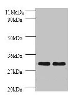 Western blot. All lanes: HLA-DPB1 antibody at 2µg/ml. Lane 1: sw1990 whole cell lysate. Lane 2: HGC27 whole cell lysate. Secondary. Goat polyclonal to rabbit IgG at 1/10000 dilution. Predicted band size: 30 kDa. Observed band size: 30 kDa