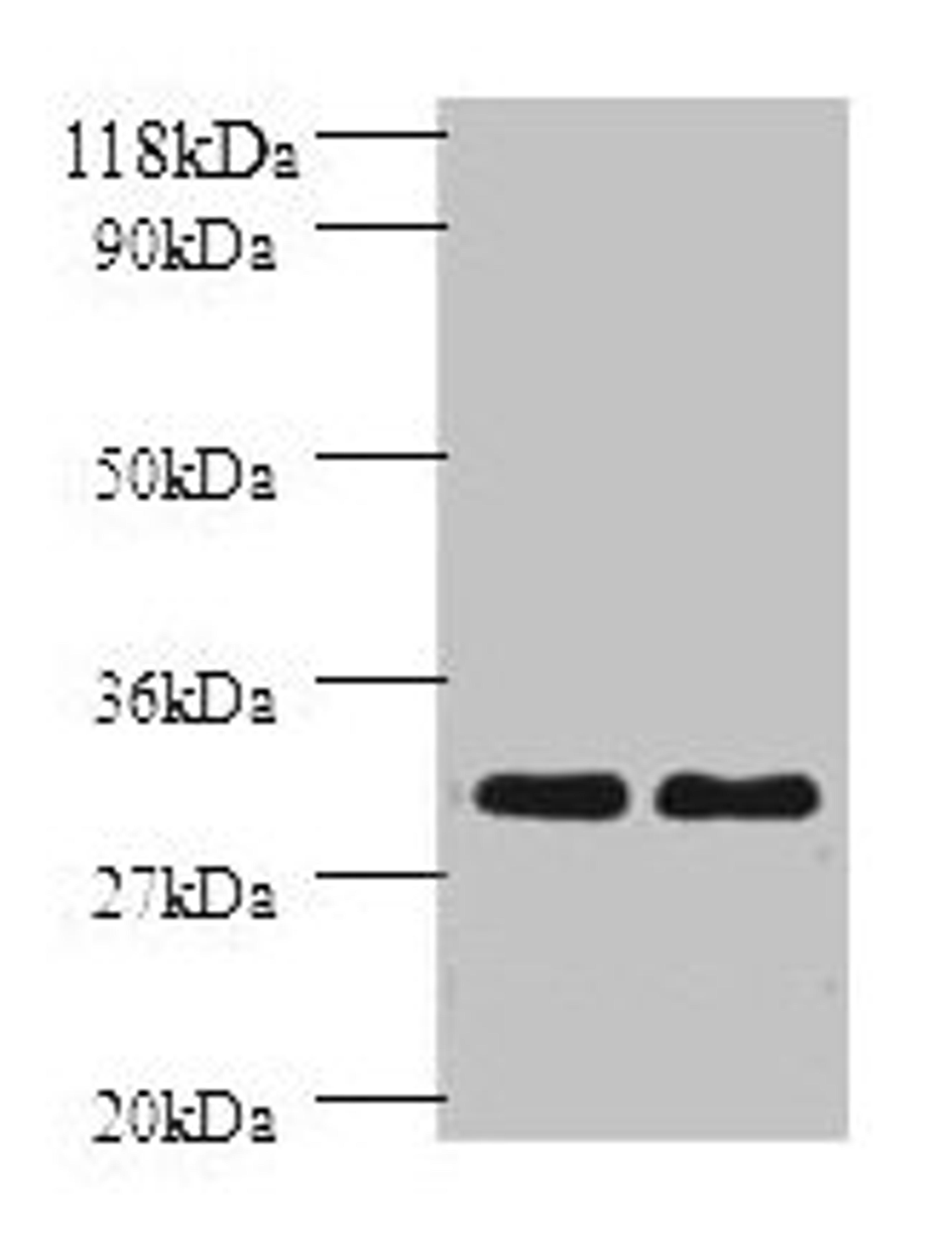 Western blot. All lanes: HLA-DPB1 antibody at 2µg/ml. Lane 1: sw1990 whole cell lysate. Lane 2: HGC27 whole cell lysate. Secondary. Goat polyclonal to rabbit IgG at 1/10000 dilution. Predicted band size: 30 kDa. Observed band size: 30 kDa