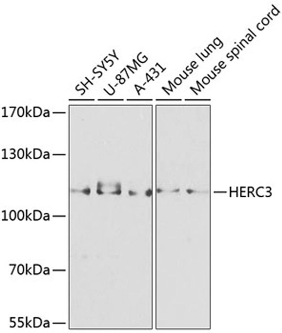 Western blot - HERC3 antibody (A8567)