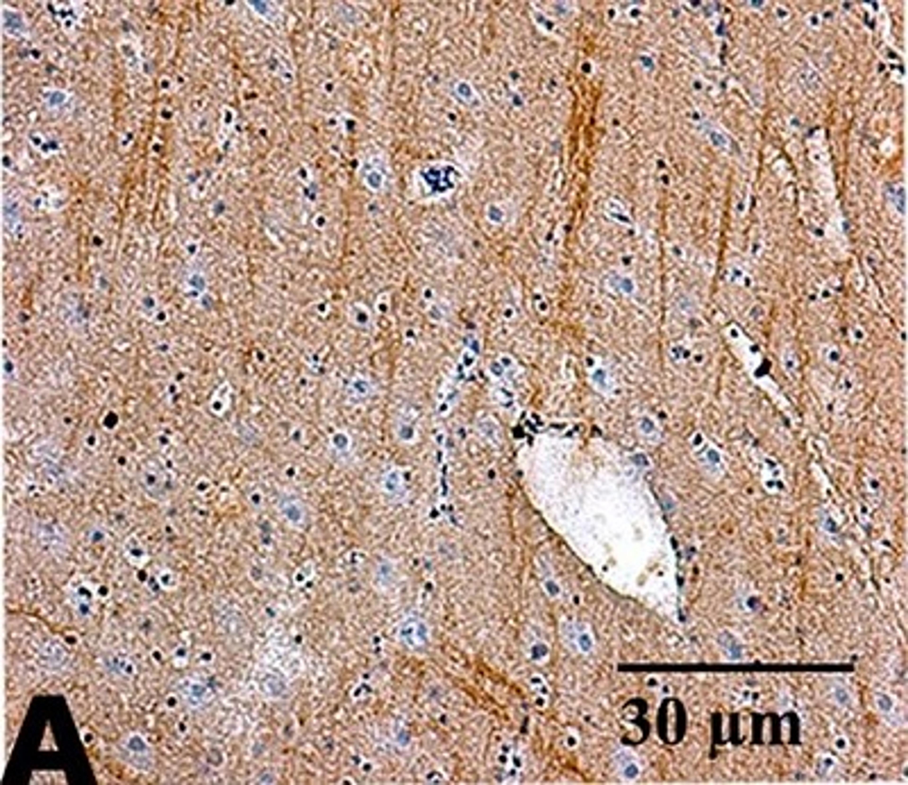 Immunohistochemistry (Formalin/PFA-fixed paraffin-embedded sections) - Goat Anti-Rabbit IgG H&L (HRP) (ab6721)