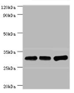 Western blot. All lanes: HNRNPA0 antibody at 12ug/ml. Lane 1: Mouse brain tissue. Lane 2: Hela whole cell lysate. Lane 3: Jurkat whole cell lysate. Secondary. Goat polyclonal to rabbit IgG at 1/10000 dilution. Predicted band size: 31 kDa. Observed band size: 31 kDa.