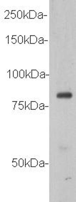 Western Blot analysis of MCF-7 lysate using Vang-like protein 1 antibody