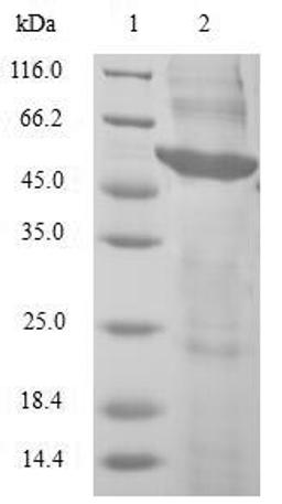(Tris-Glycine gel) Discontinuous SDS-PAGE (reduced) with 5% enrichment gel and 15% separation gel.
