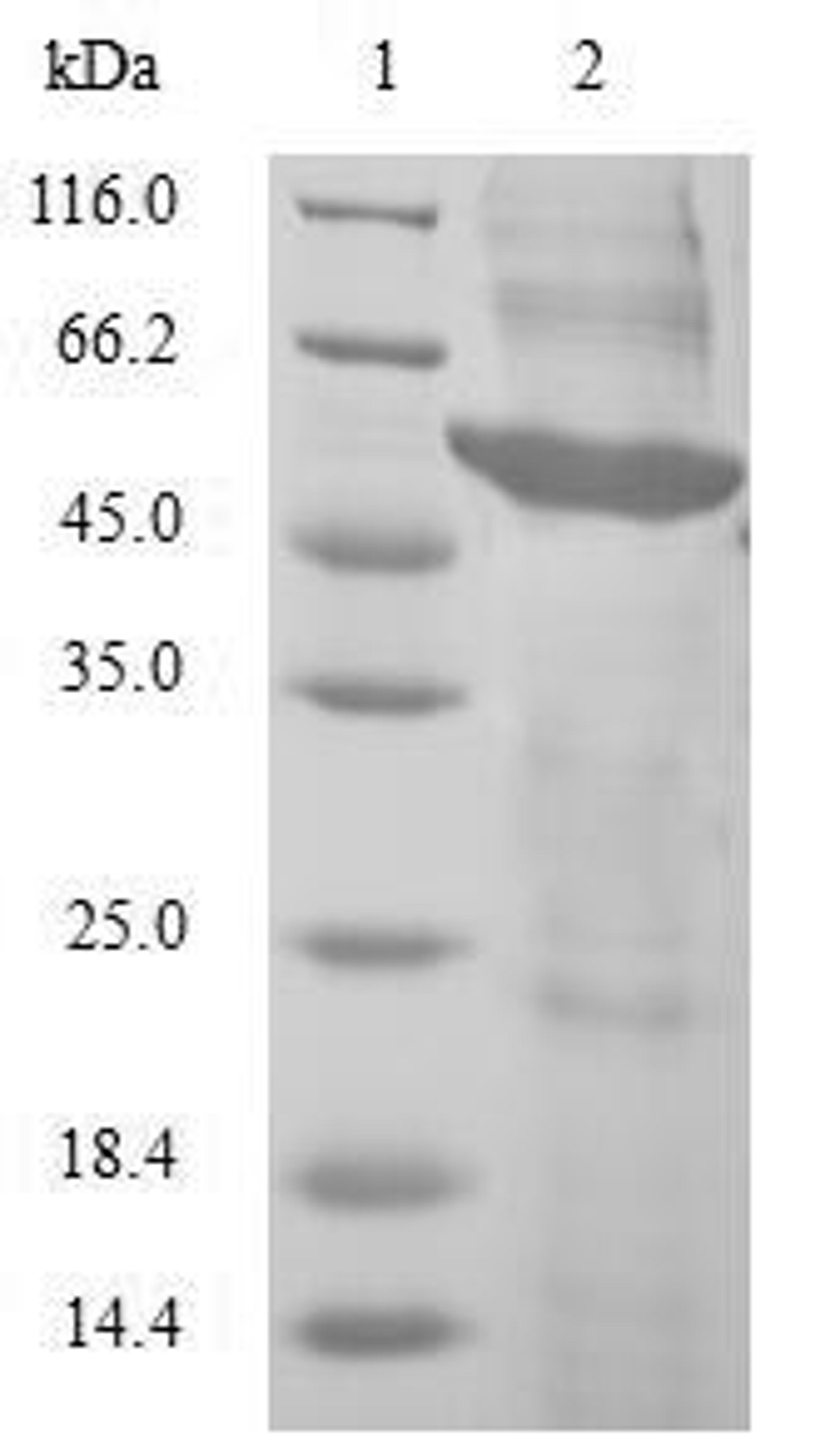 (Tris-Glycine gel) Discontinuous SDS-PAGE (reduced) with 5% enrichment gel and 15% separation gel.