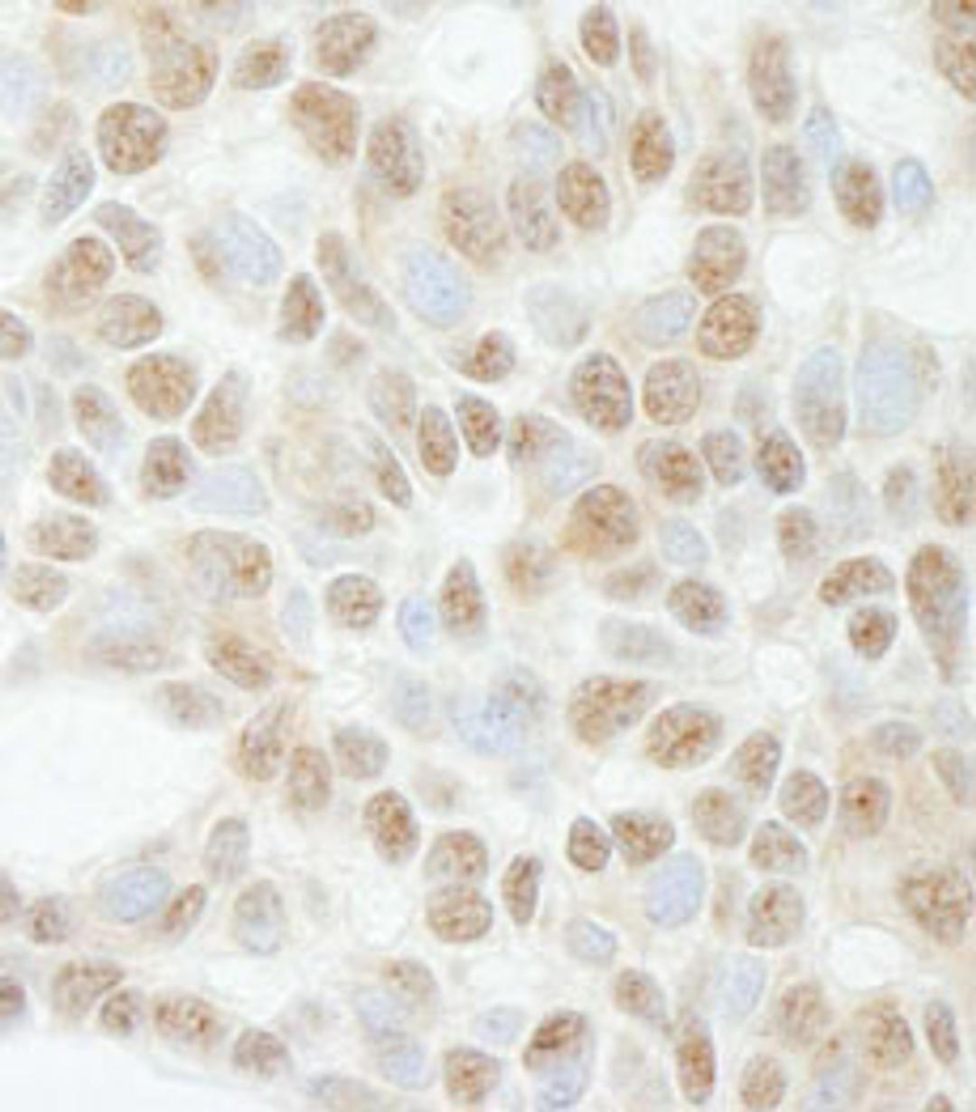 Detection of human ADNP by immunohistochemistry.