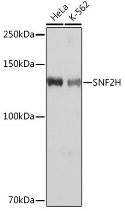 Western blot - SNF2H Rabbit mAb (A3539)