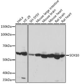 Western blot - SOX10 Rabbit mAb (A8655)