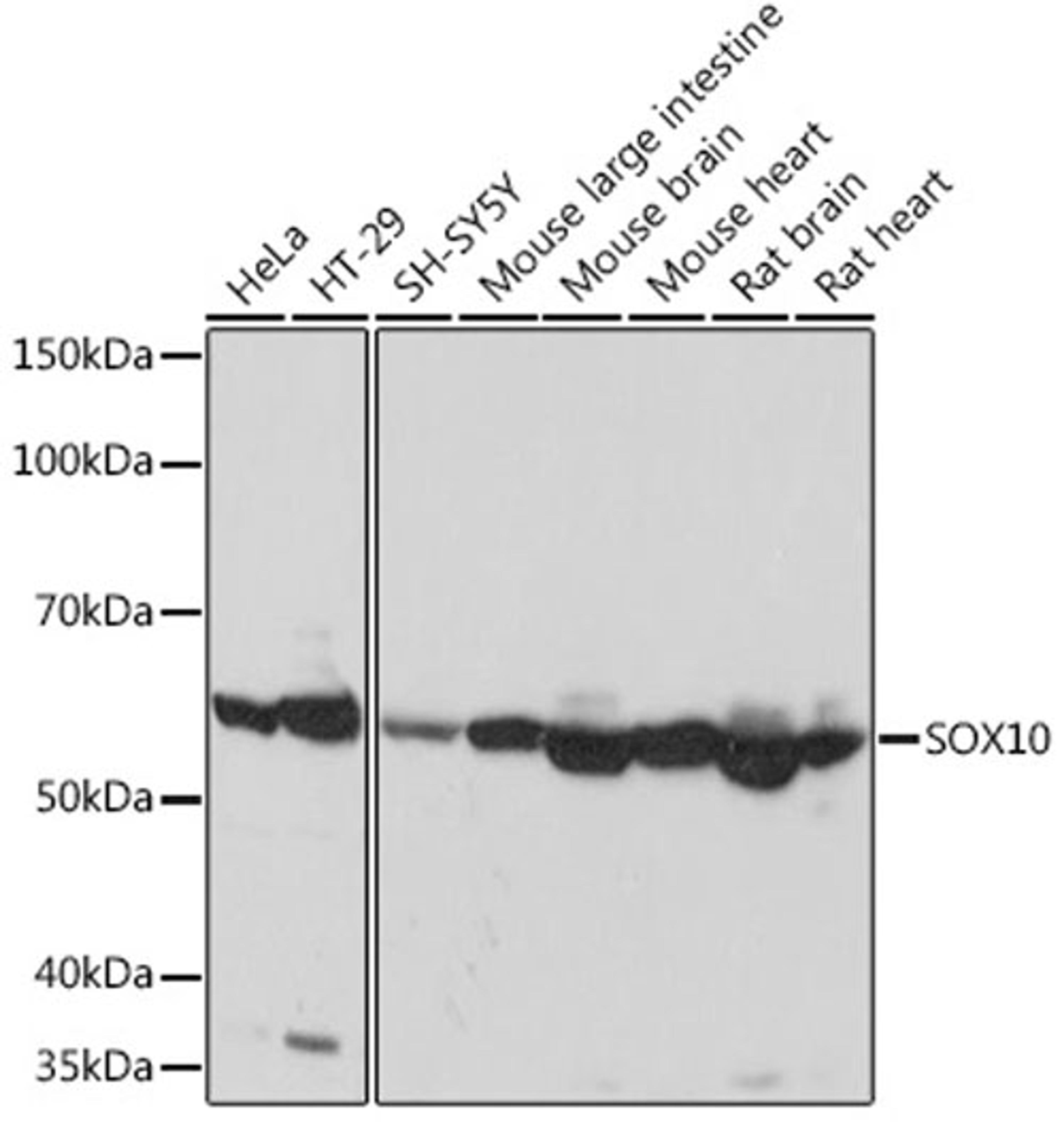 Western blot - SOX10 Rabbit mAb (A8655)