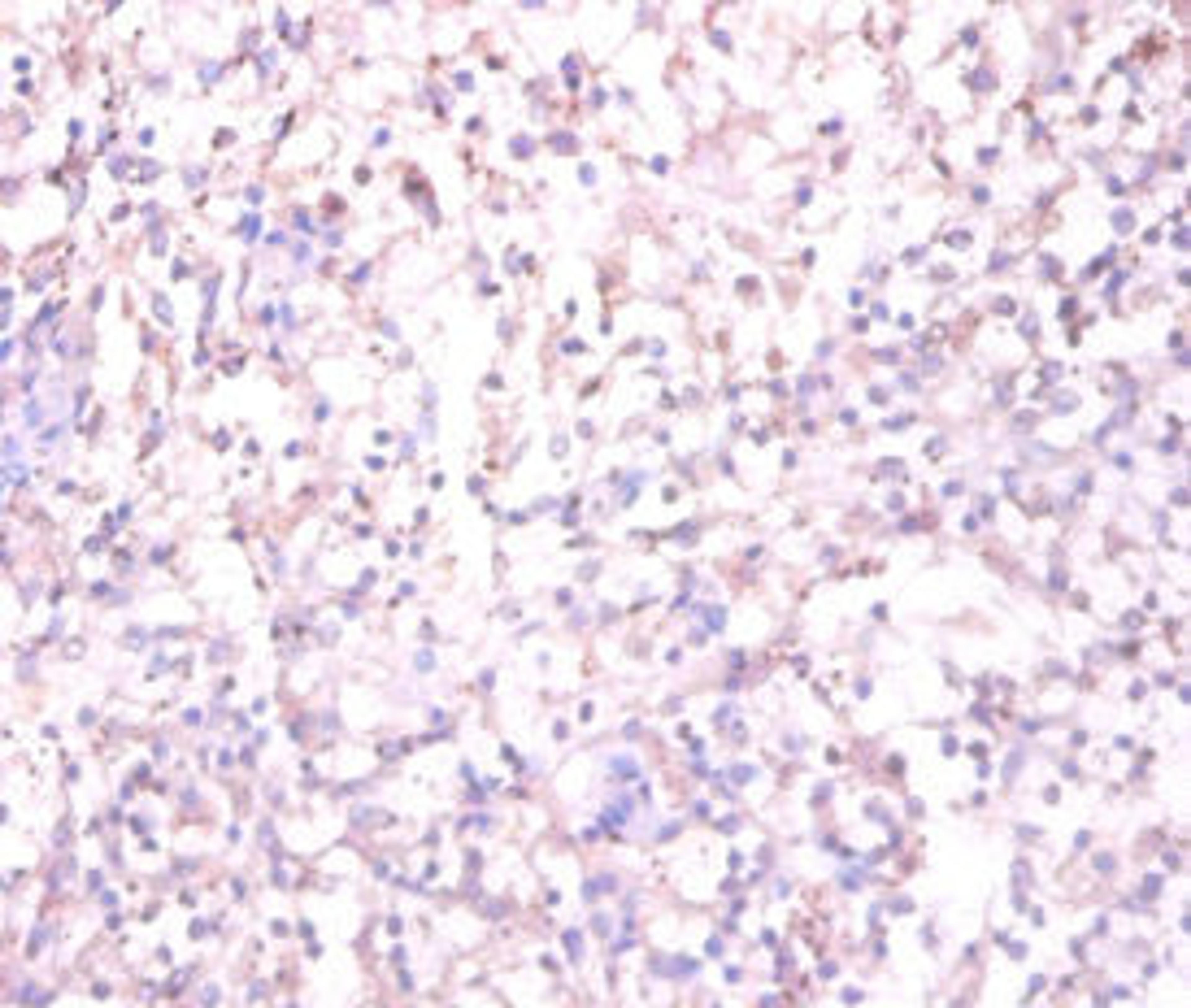 Immunohistochemistry of paraffin-embedded human spleen tissue using CSB-PA09674A0Rb at dilution of 1:100