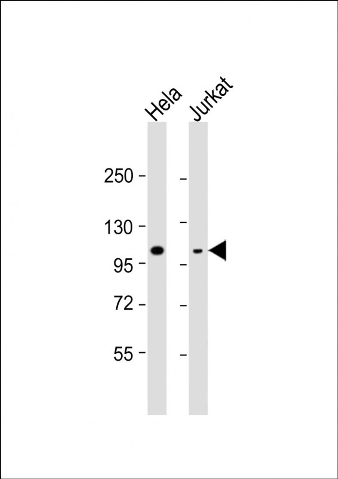 Western Blot at 1:8000 dilution Lane 1: Hela whole cell lysate Lane 2: Jurkat whole cell lysate Lysates/proteins at 20 ug per lane.