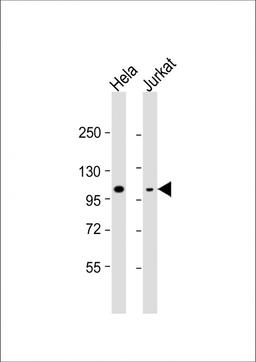 Western Blot at 1:8000 dilution Lane 1: Hela whole cell lysate Lane 2: Jurkat whole cell lysate Lysates/proteins at 20 ug per lane.