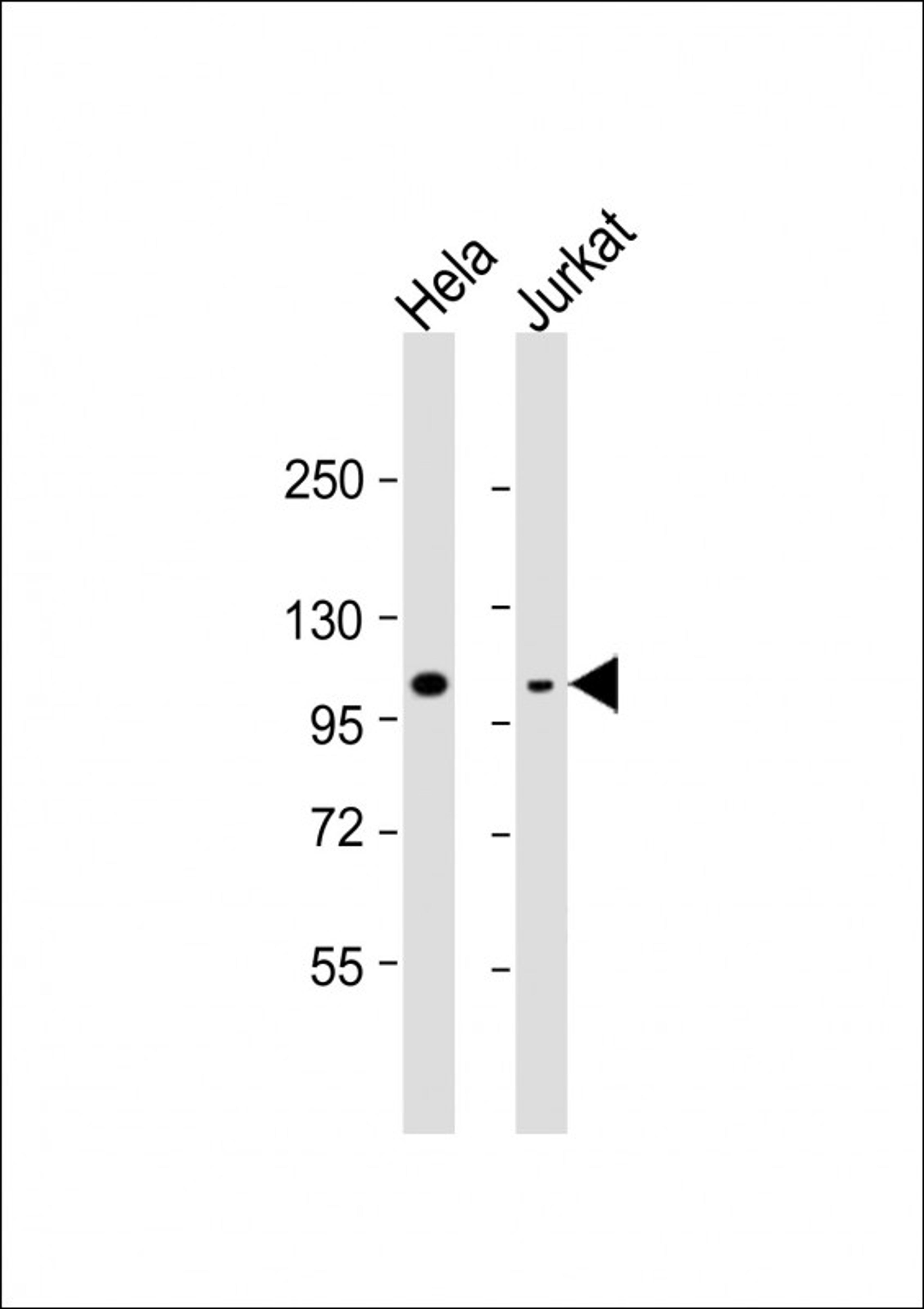 Western Blot at 1:8000 dilution Lane 1: Hela whole cell lysate Lane 2: Jurkat whole cell lysate Lysates/proteins at 20 ug per lane.