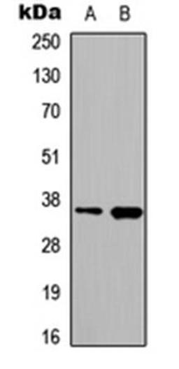 Western blot analysis of HeLa (Lane1), PC3 (Lane2) whole cell using hnRNP A2/B1 antibody