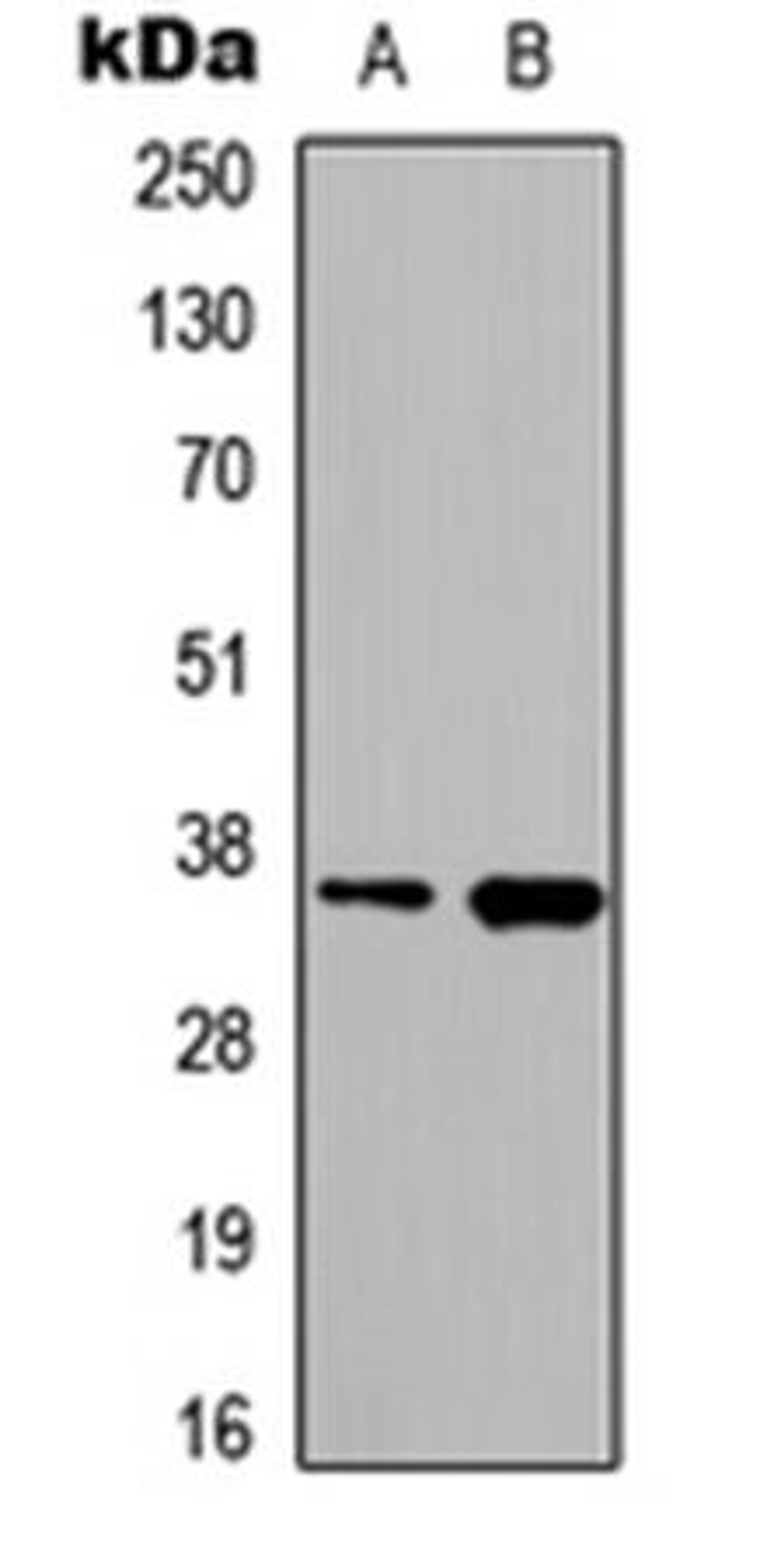 Western blot analysis of HeLa (Lane1), PC3 (Lane2) whole cell using hnRNP A2/B1 antibody