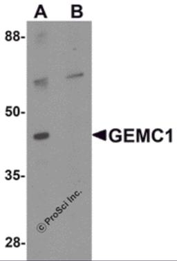 Western blot analysis of GEMC1 in mouse heart tissue lysate with GEMC1 antibody at 1 μg/mL in (A) the absence and (B) the presence of blocking peptide