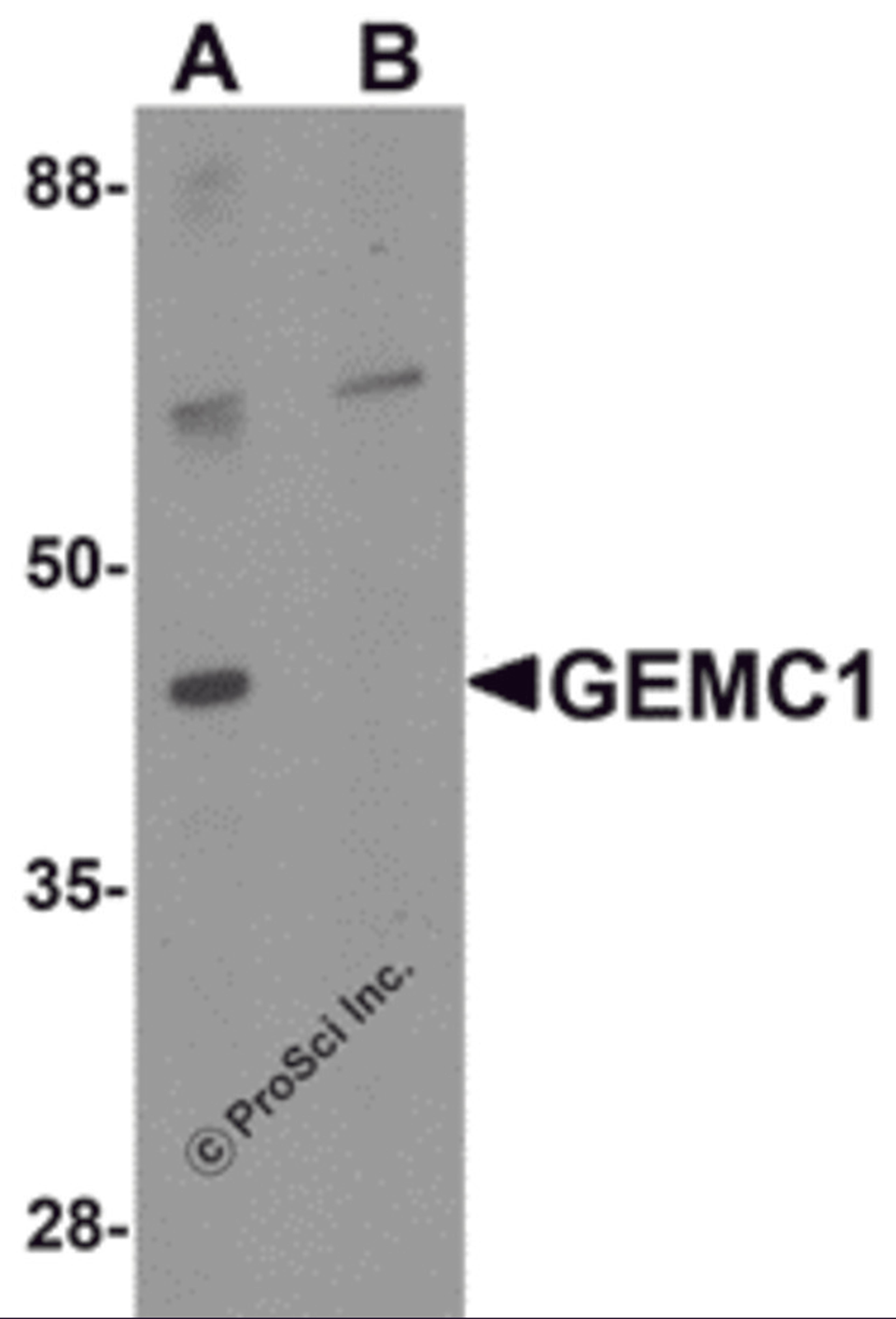 Western blot analysis of GEMC1 in mouse heart tissue lysate with GEMC1 antibody at 1 μg/mL in (A) the absence and (B) the presence of blocking peptide