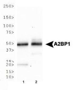 Western Blot: A2BP1 Antibody (D8H8) [NBP2-13169] - Western blot analysis of A2BP1 expression in 1) human brain and 2) mouse brain tissue lysates.