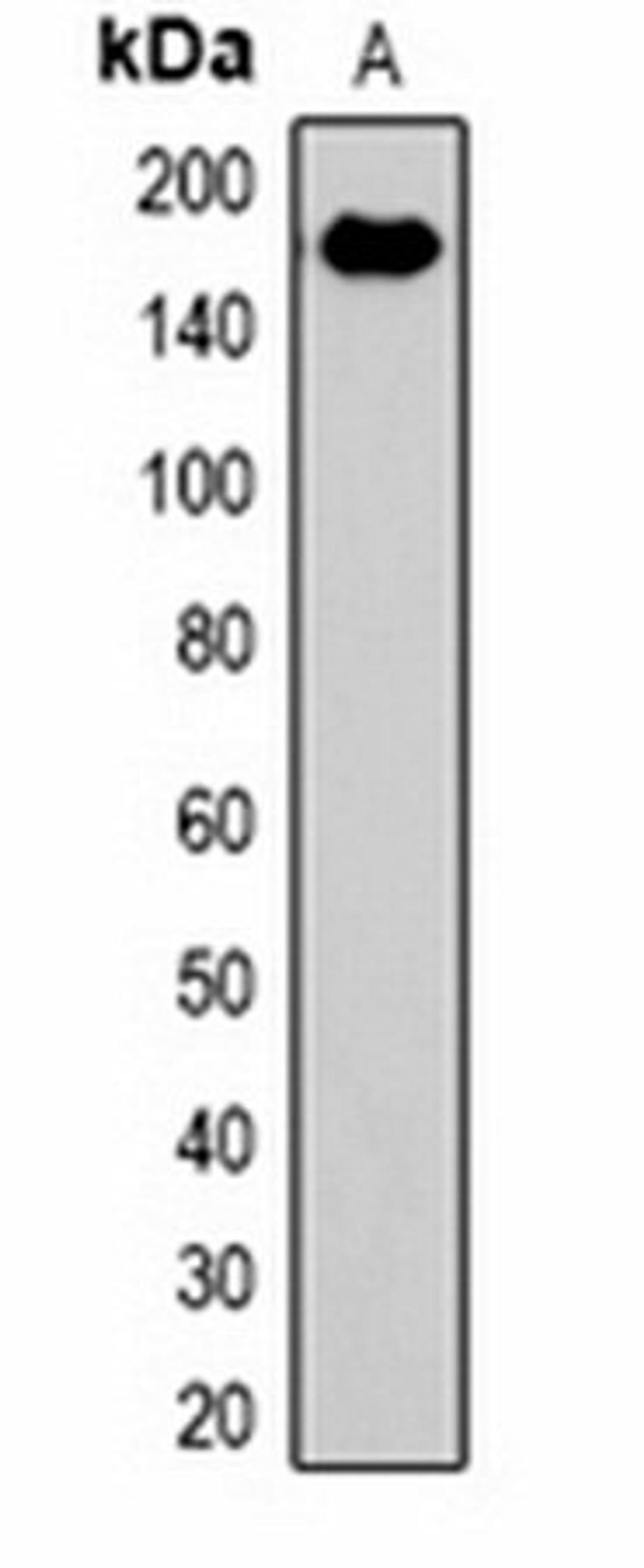 Western blot analysis of rat liver (Lane 1) whole cell lysates using EPG5 antibody