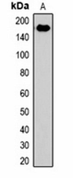 Western blot analysis of rat liver (Lane 1) whole cell lysates using EPG5 antibody