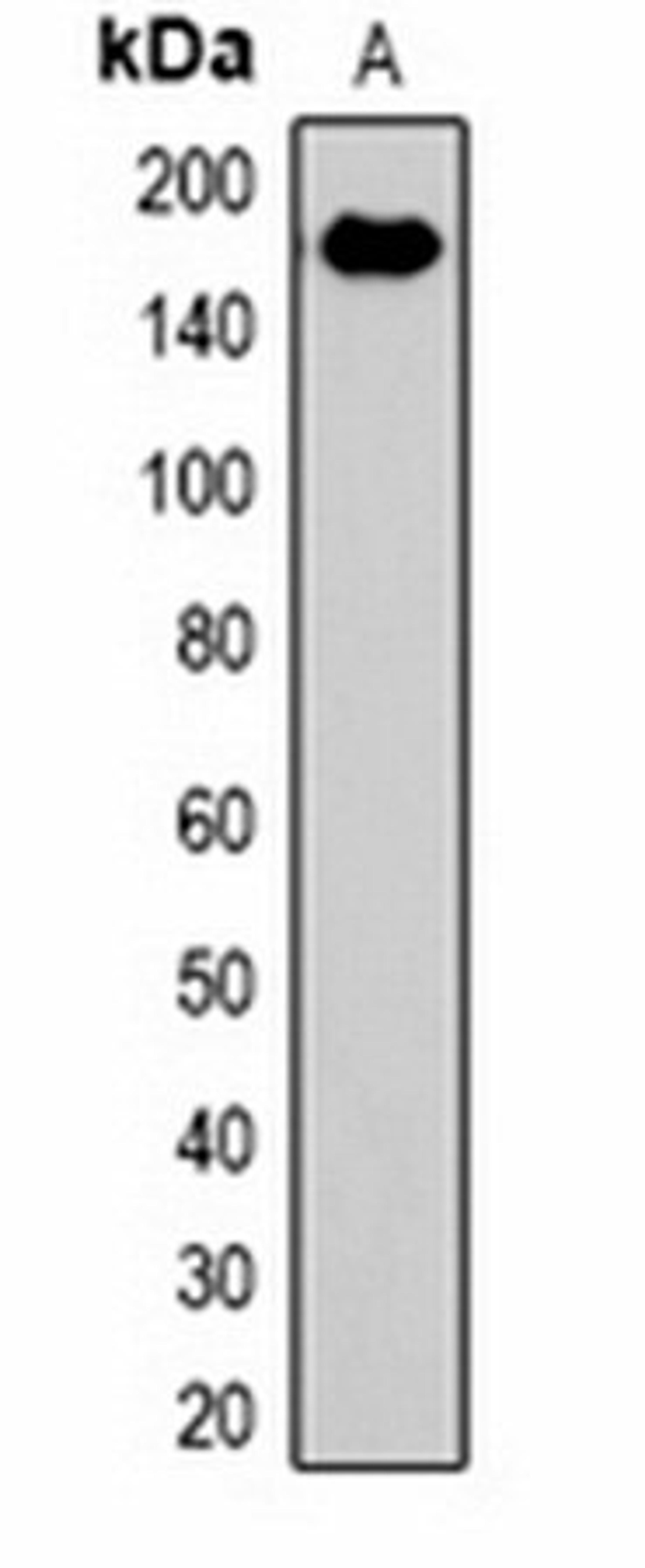 Western blot analysis of rat liver (Lane 1) whole cell lysates using EPG5 antibody