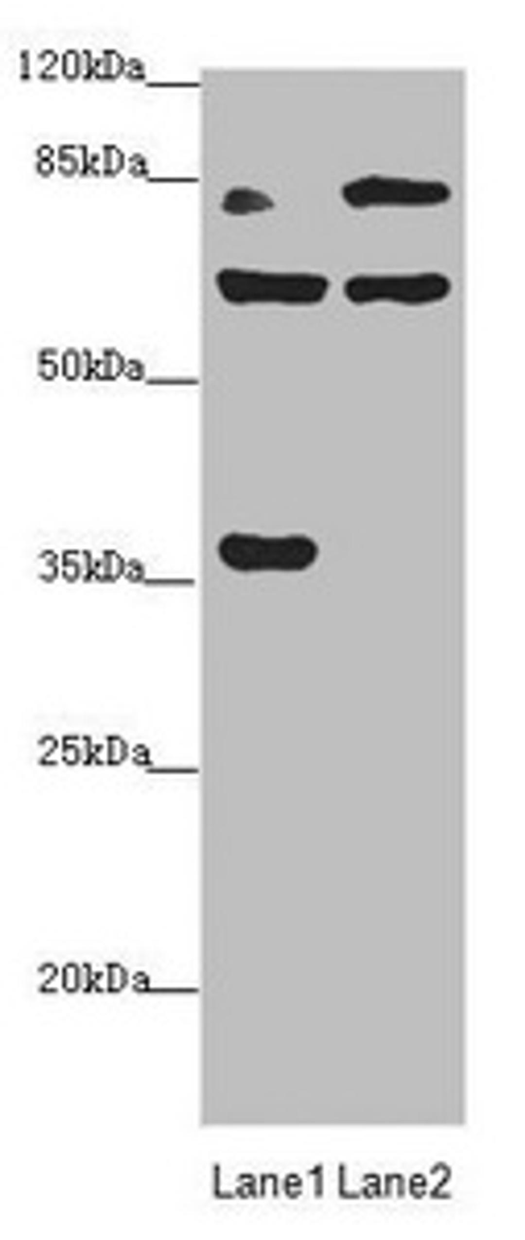 Western blot. All lanes: MTO1 antibody at 2.25µg/ml. Lane 1: Rat heart tissue. Lane 2: Jurkat whole cell lysate. Secondary. Goat polyclonal to rabbit IgG at 1/10000 dilution. Predicted band size: 80, 67, 35, 78, 73, 82 kDa. Observed band size: 80, 67, 35 kDa