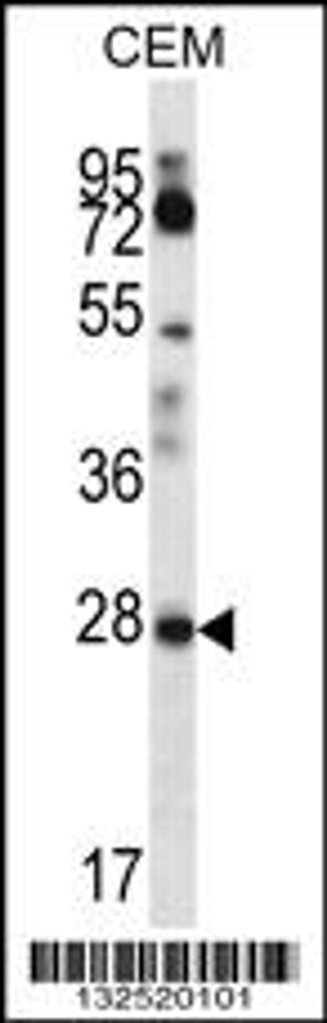 Western blot analysis in CEM cell line lysates (35ug/lane).