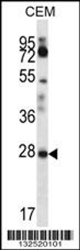 Western blot analysis in CEM cell line lysates (35ug/lane).