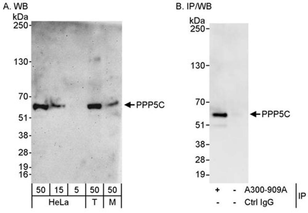 Detection of human and mouse PPP5C by WB and IP.