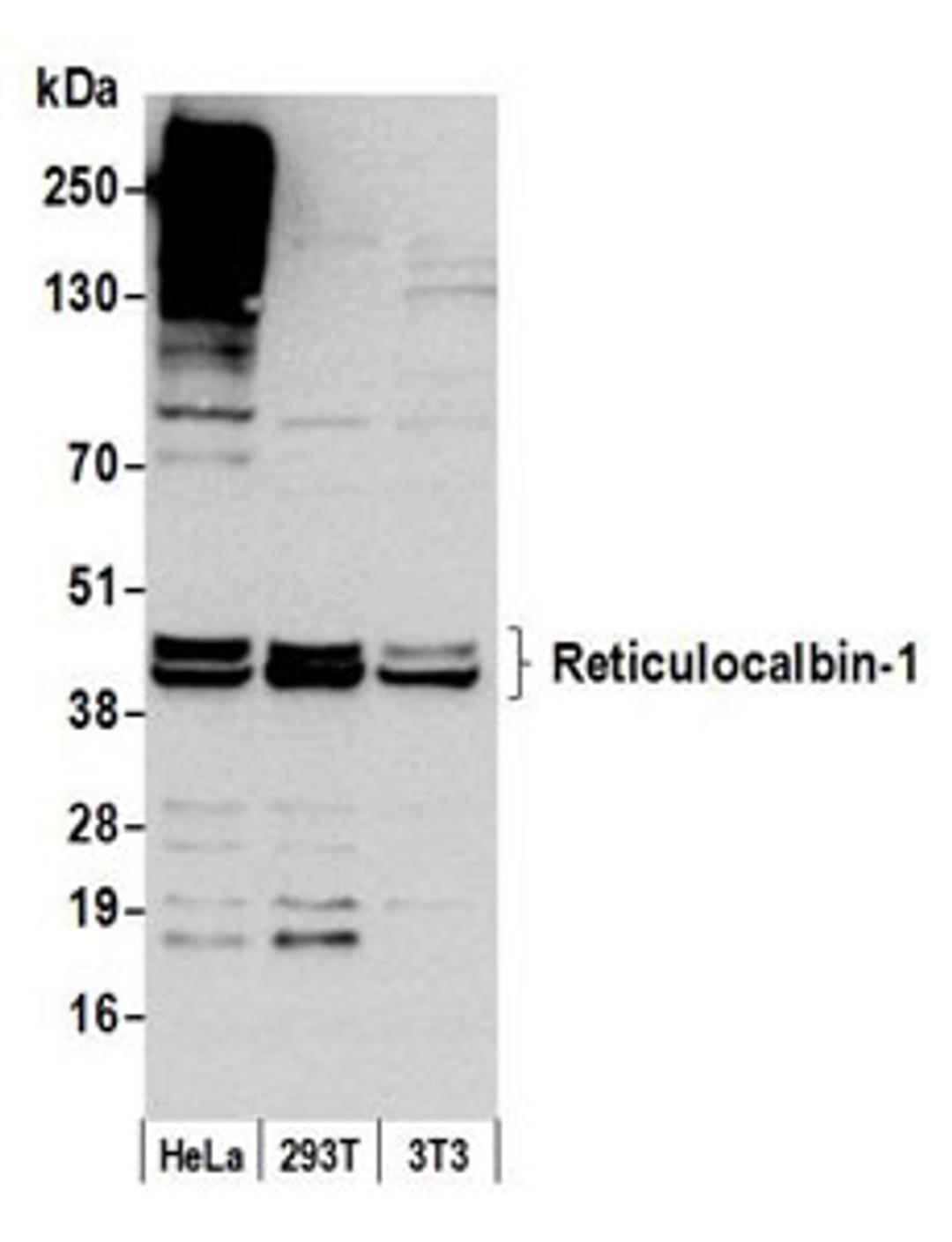 Detection of human and mouse Reticulocalbin-1 by western blot.