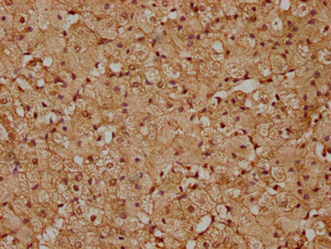 IHC image of CSB-PA819455LA01HU diluted at 1:200 and staining in paraffin-embedded human adrenal gland tissue performed on a Leica BondTM system. After dewaxing and hydration, antigen retrieval was mediated by high pressure in a citrate buffer (pH 6.0). Section was blocked with 10% normal goat serum 30min at RT. Then primary antibody (1% BSA) was incubated at 4°C overnight. The primary is detected by a biotinylated secondary antibody and visualized using an HRP conjugated SP system.