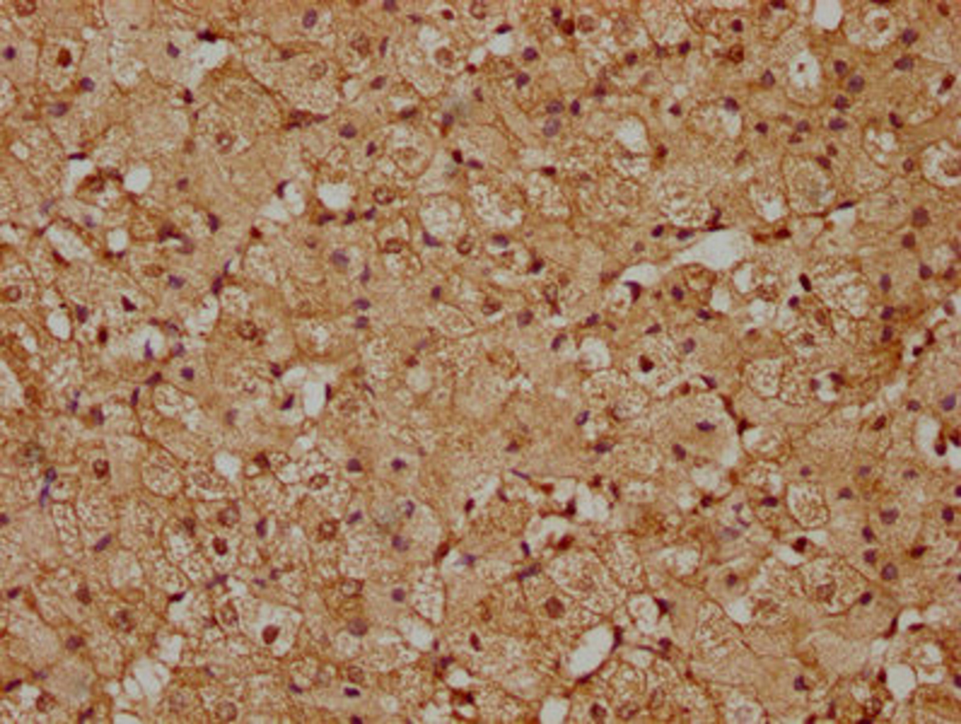 IHC image of CSB-PA819455LA01HU diluted at 1:200 and staining in paraffin-embedded human adrenal gland tissue performed on a Leica BondTM system. After dewaxing and hydration, antigen retrieval was mediated by high pressure in a citrate buffer (pH 6.0). Section was blocked with 10% normal goat serum 30min at RT. Then primary antibody (1% BSA) was incubated at 4°C overnight. The primary is detected by a biotinylated secondary antibody and visualized using an HRP conjugated SP system.