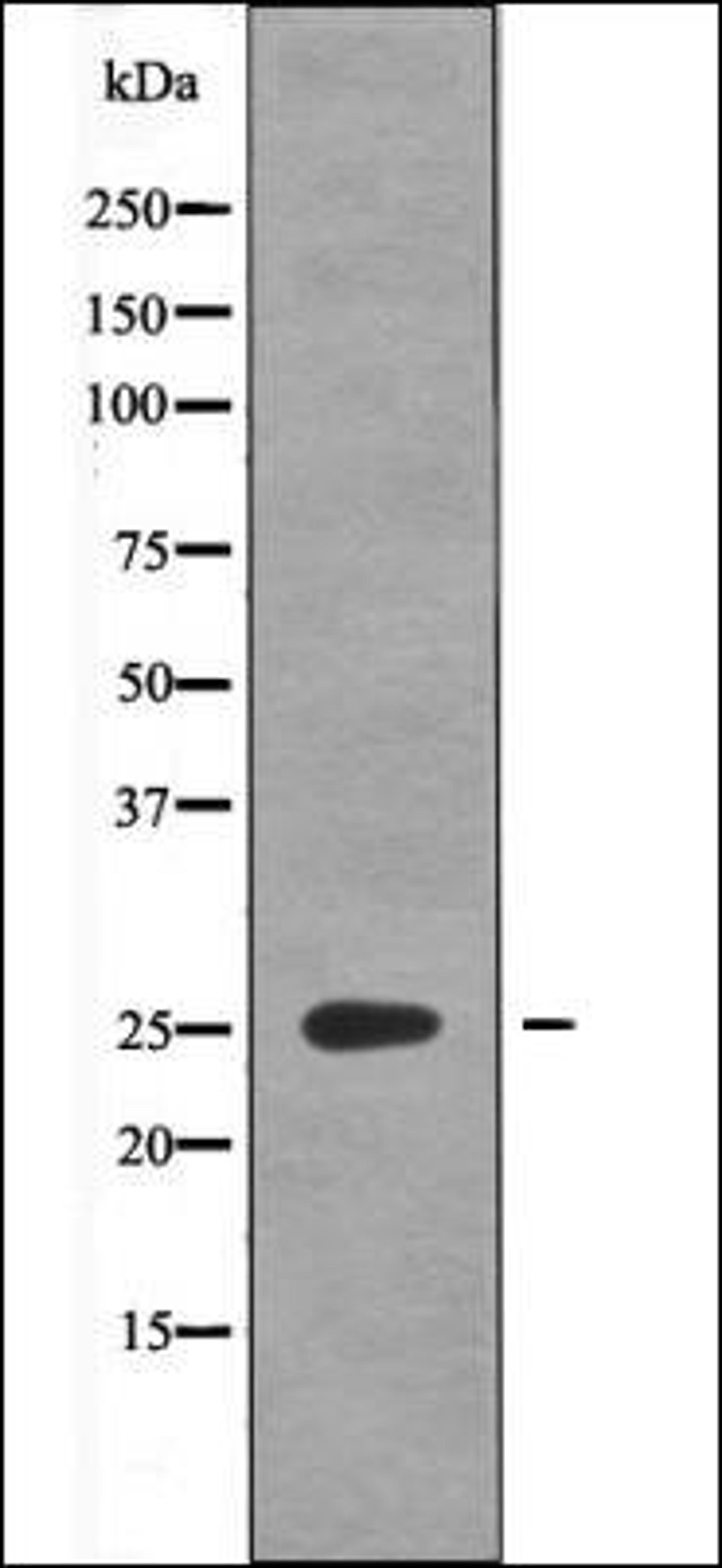 Western blot analysis of UV treated K562 whole cell lysates using GAIP -Phospho-Ser151- antibody