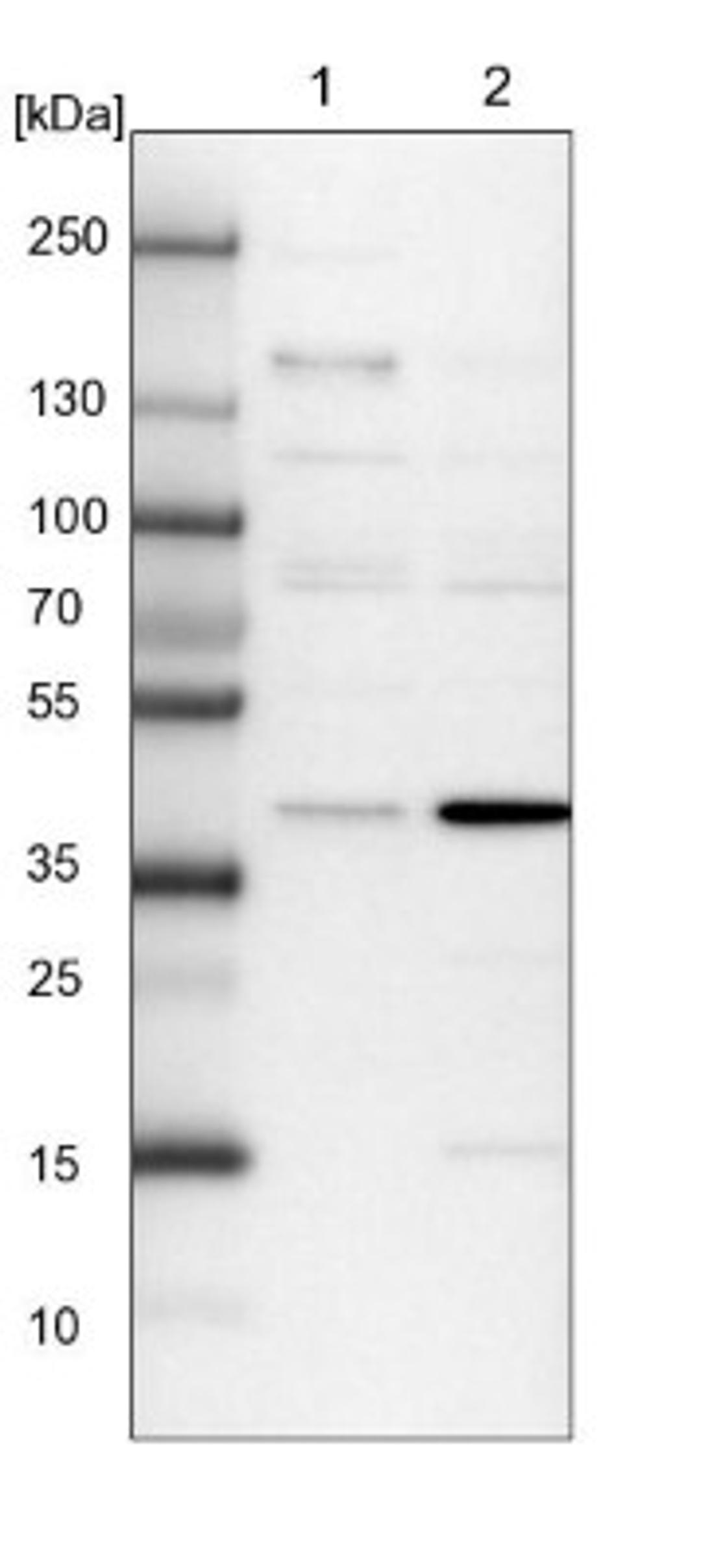 Western Blot: C6orf168 Antibody [NBP1-90579] - Lane 1: NIH-3T3 cell lysate (Mouse embryonic fibroblast cells)<br/>Lane 2: NBT-II cell lysate (Rat Wistar bladder tumour cells)