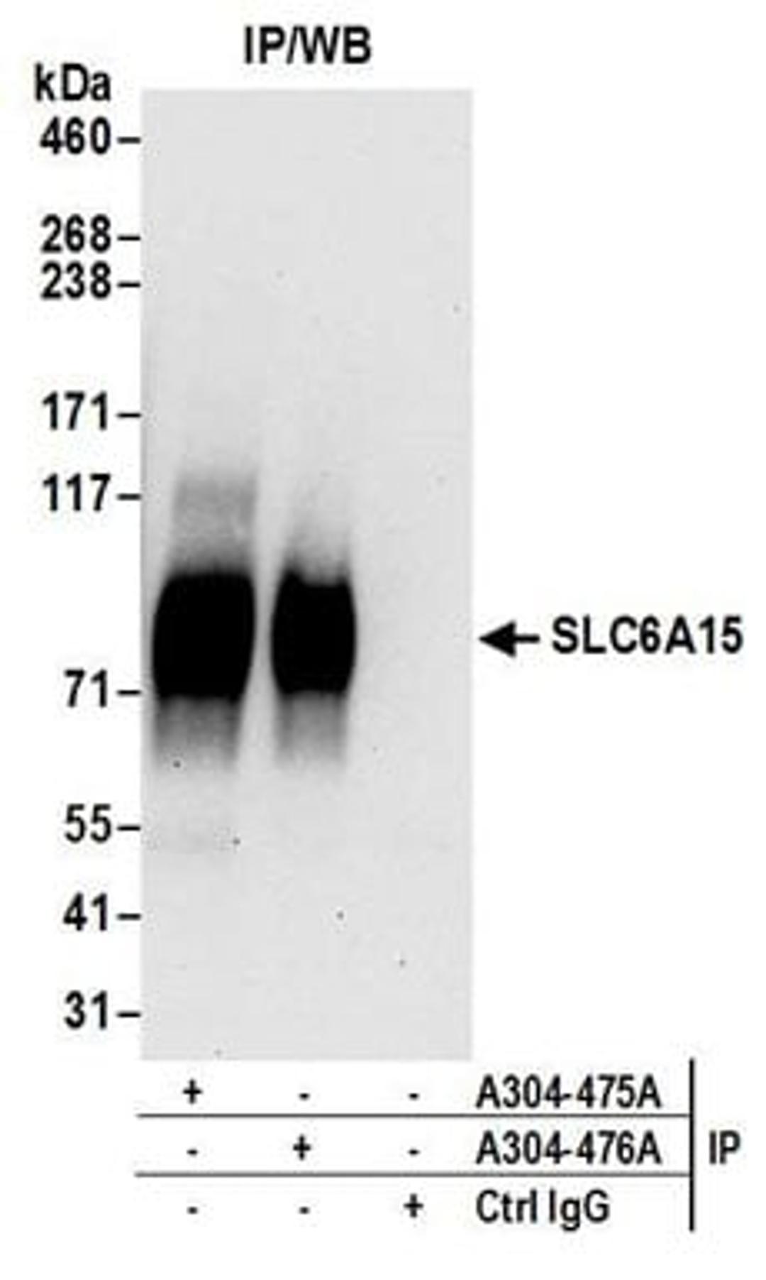 Detection of human SLC6A15 by western blot of immunoprecipitates.