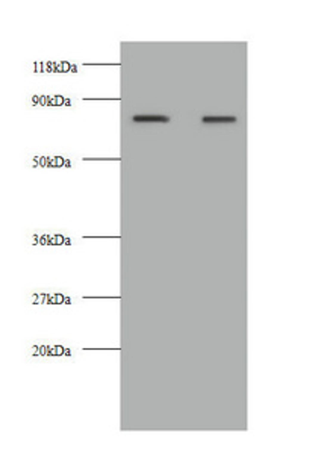Western blot. All lanes: KNG1 antibody at 2µg/ml. Lane 1: HepG2 whole cell lysate. Lane 2: 293T whole cell lysate. Secondary. Goat polyclonal to rabbit IgG at 1/10000 dilution. Predicted band size: 72, 48, 44 kDa. Observed band size: 72 kDa