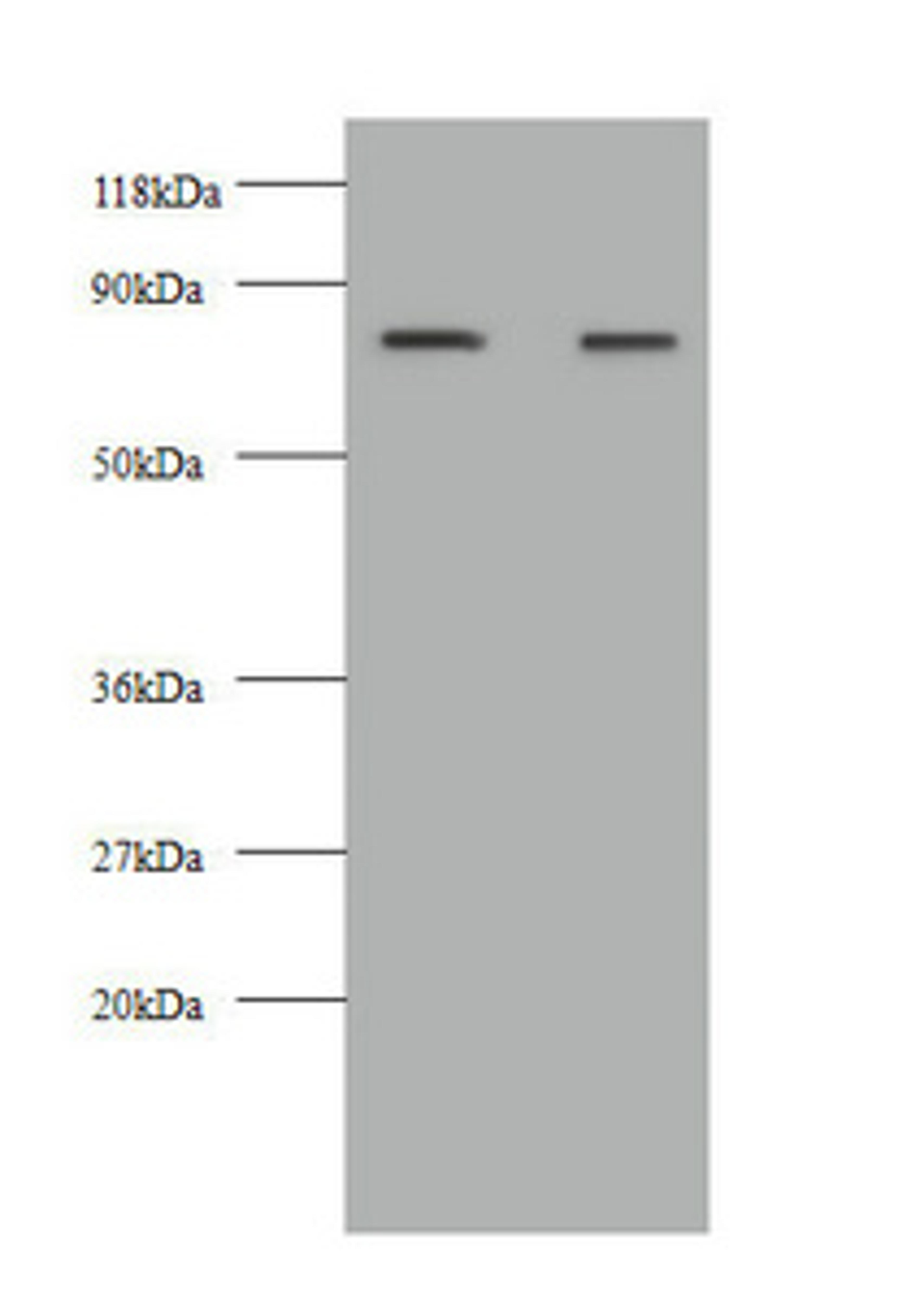 Western blot. All lanes: KNG1 antibody at 2µg/ml. Lane 1: HepG2 whole cell lysate. Lane 2: 293T whole cell lysate. Secondary. Goat polyclonal to rabbit IgG at 1/10000 dilution. Predicted band size: 72, 48, 44 kDa. Observed band size: 72 kDa