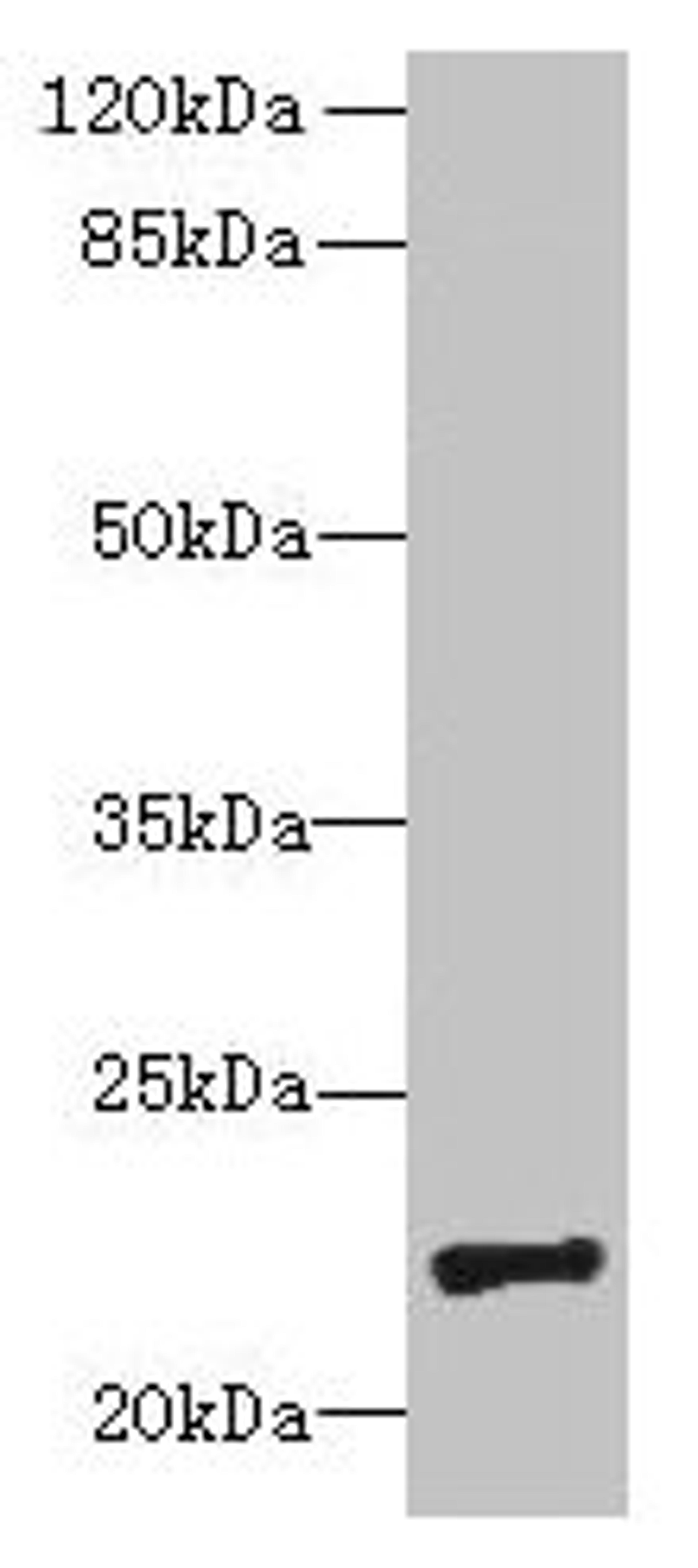 Western blot. All lanes: PIGH antibody at 4µg/ml + Mouse kidney tissue. Secondary. Goat polyclonal to rabbit IgG at 1/10000 dilution. Predicted band size: 22 kDa. Observed band size: 22 kDa