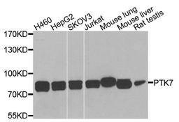 Western blot analysis of extracts of various cells using PTK7 antibody