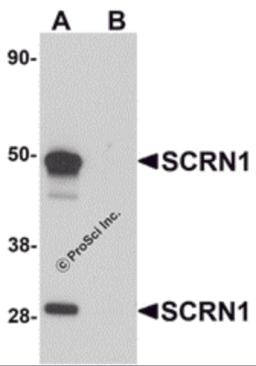 Western blot analysis of SCRN1 in human kidney tissue lysate with SCRN1 antibody at 1 &#956;g/mL in (A) the absence and (B) the presence of blocking peptide.