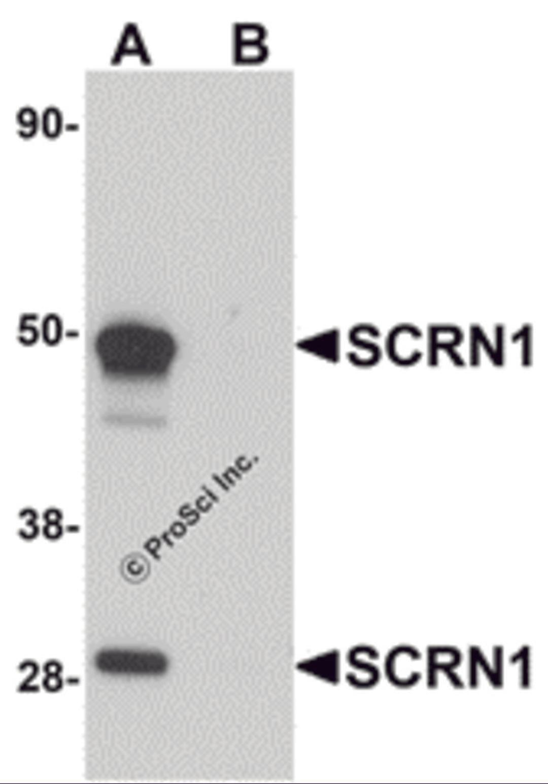 Western blot analysis of SCRN1 in human kidney tissue lysate with SCRN1 antibody at 1 μg/mL in (A) the absence and (B) the presence of blocking peptide.