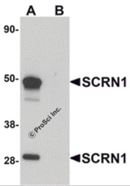 Western blot analysis of SCRN1 in human kidney tissue lysate with SCRN1 antibody at 1 μg/mL in (A) the absence and (B) the presence of blocking peptide.