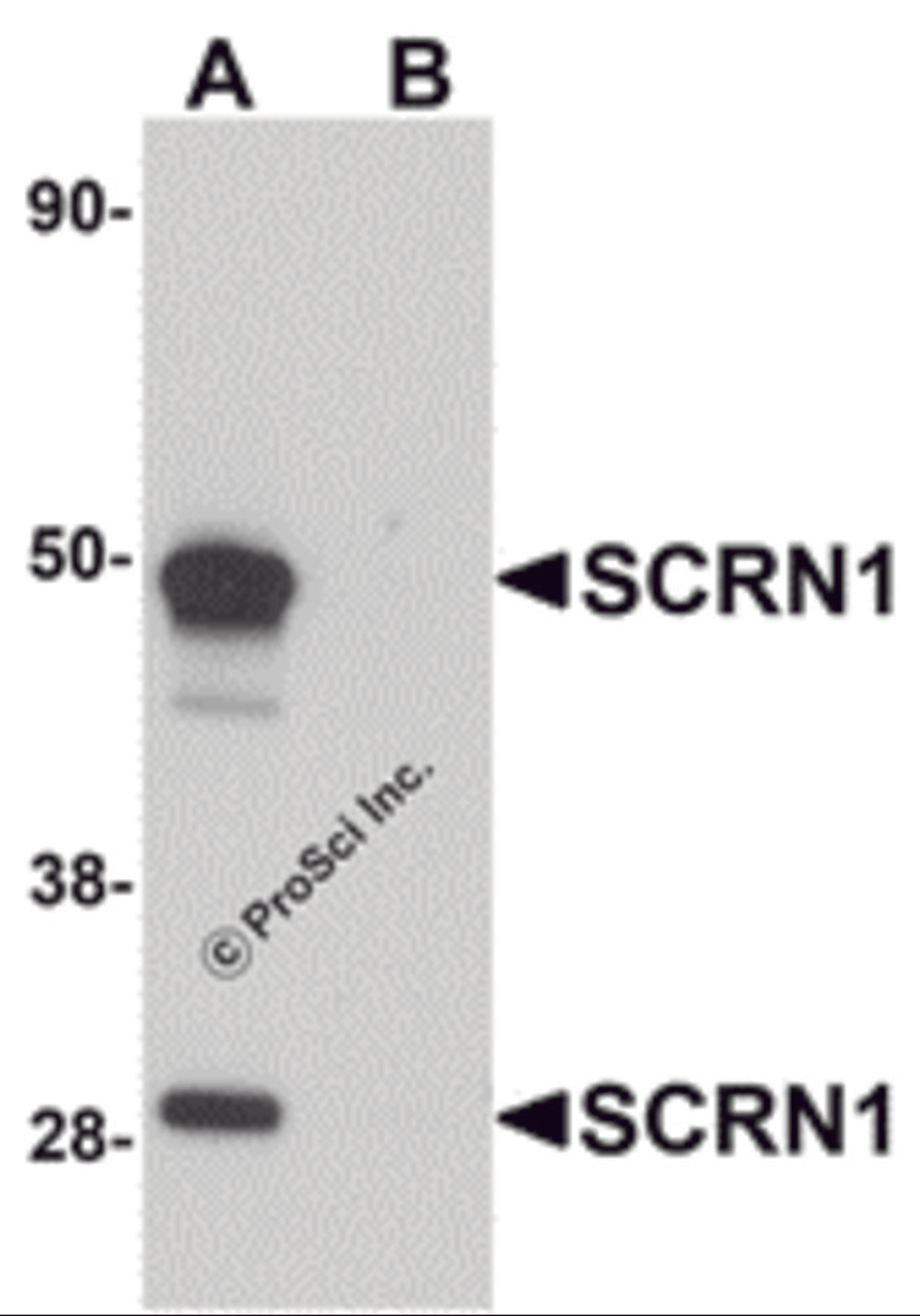 Western blot analysis of SCRN1 in human kidney tissue lysate with SCRN1 antibody at 1 μg/mL in (A) the absence and (B) the presence of blocking peptide.