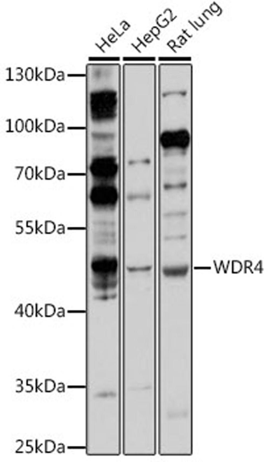 Western blot - WDR4 antibody (A16487)