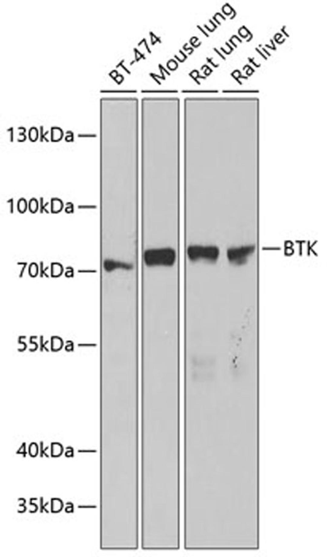 Western blot - BTK antibody (A12738)