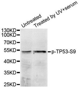 Western blot analysis of extracts of 293 cell lines using P53 (phospho-Ser9) antibody