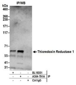 Detection of human Thioredoxin Reductase 1 by western blot of immunoprecipitates.