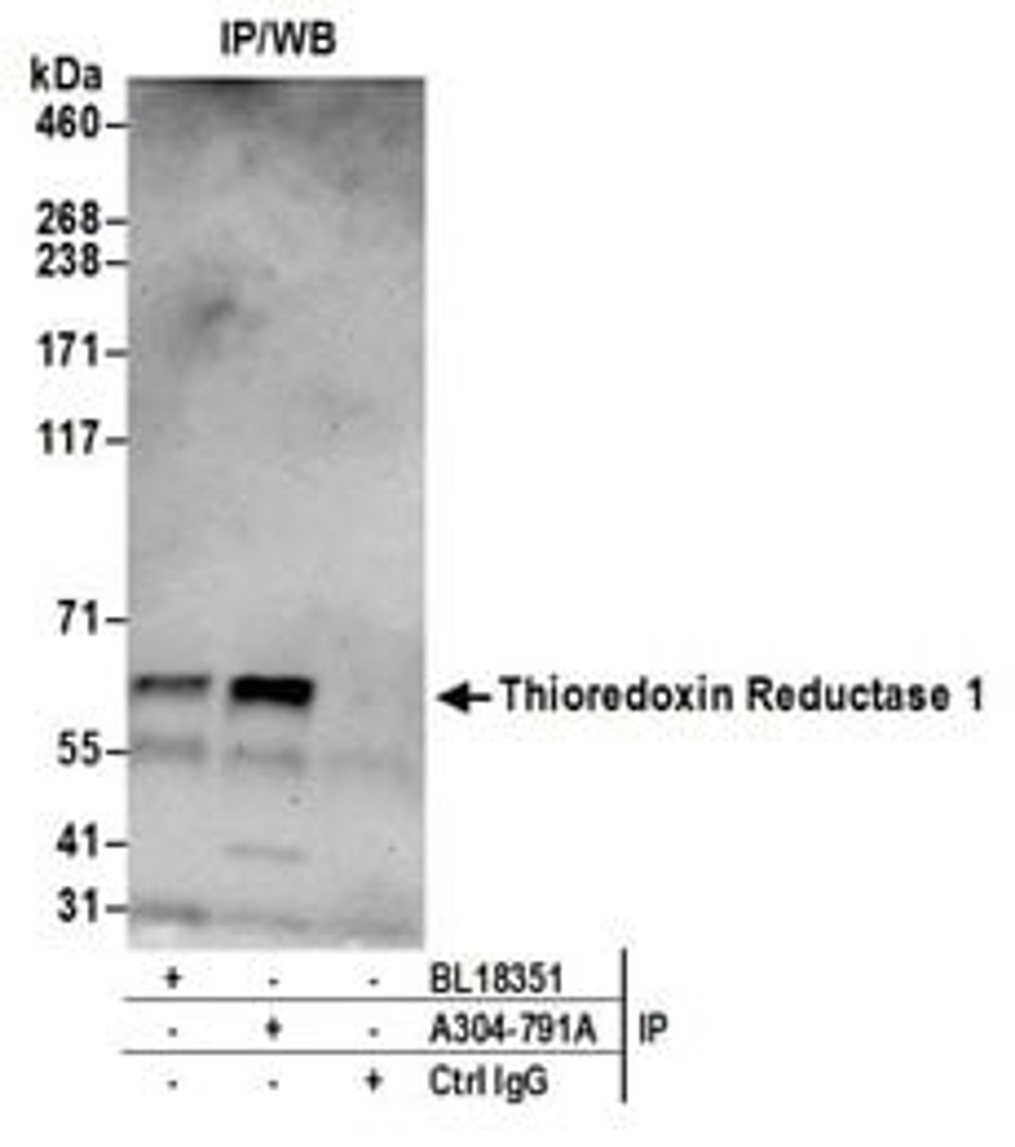 Detection of human Thioredoxin Reductase 1 by western blot of immunoprecipitates.