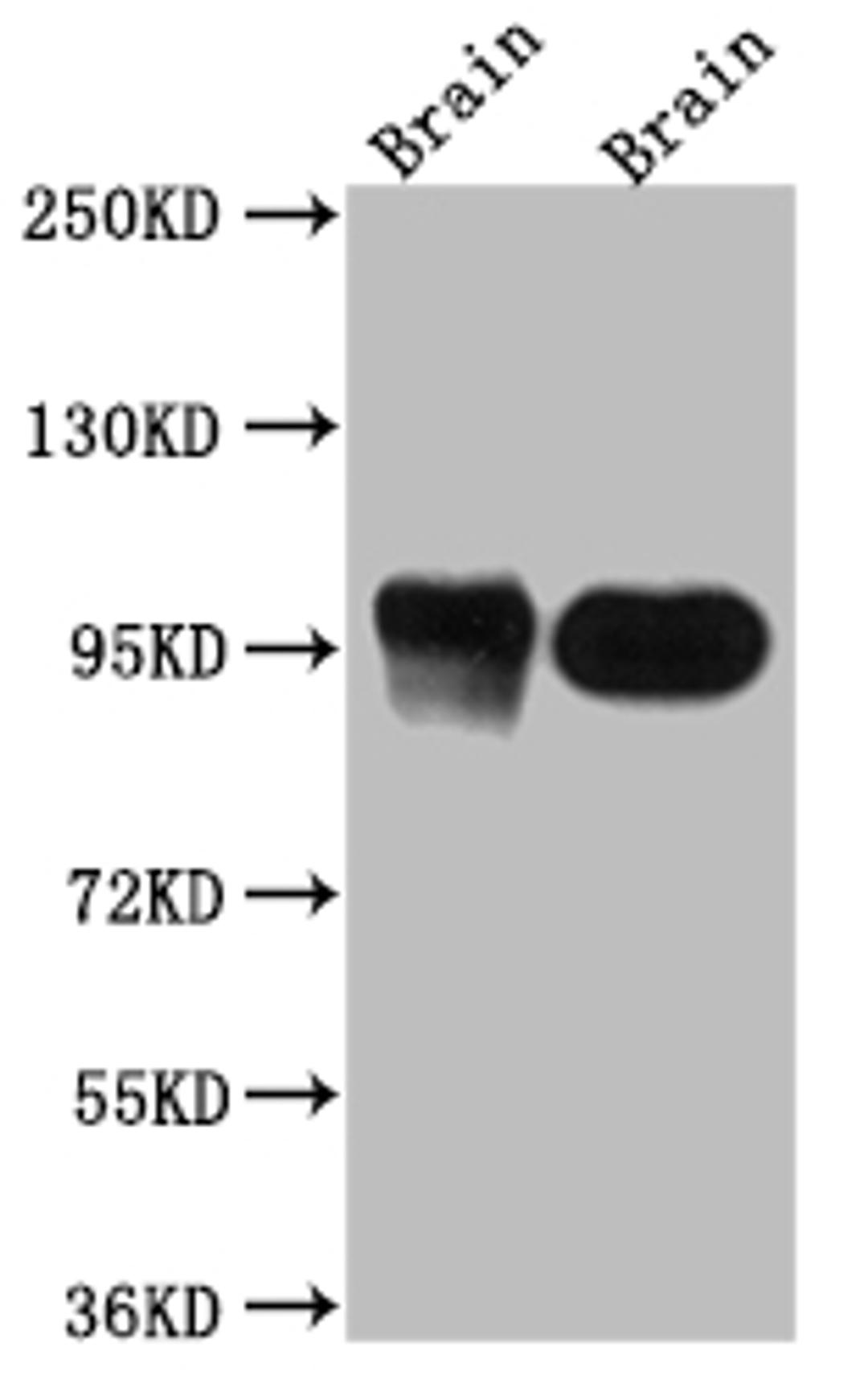 Western Blot. Positive WB detected in: Rat Brain whole cell lysate, Mouse Brain whole cell lysate. All lanes: PSD95 antibody at 1:1000. Secondary. Goat polyclonal to rabbit IgG at 1/50000 dilution. Predicted band size: 81, 86, 81 kDa. Observed band size: 95 kDa. 